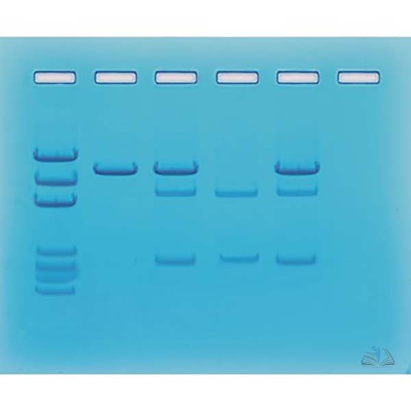 Cancer Gene Detection Kit