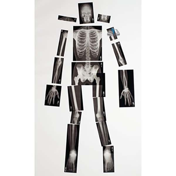 Human Skeleton