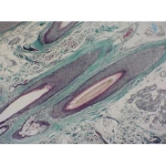 Prepared Microscope Slide Set - Human Scalp and Hair
