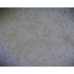 Prepared Microscope Slide - Human Blood Smear (Unstained)