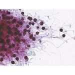 Prepared Microscope Slide - Bread Mould (Rhizopus stolonifer) with Sporangia W.M.
