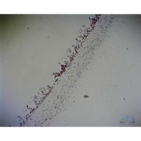 Prepared Microscope Slide - Penicillium with Hyphae and Conidiospores