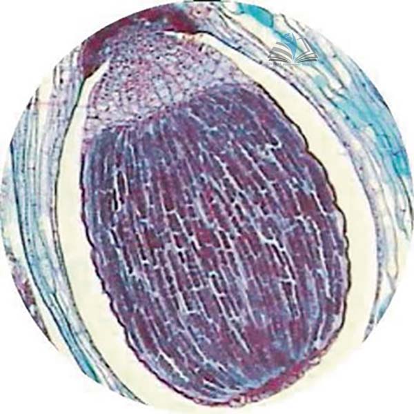 Prepared Microscope Slide - Lycopodium Strobilus L.S.