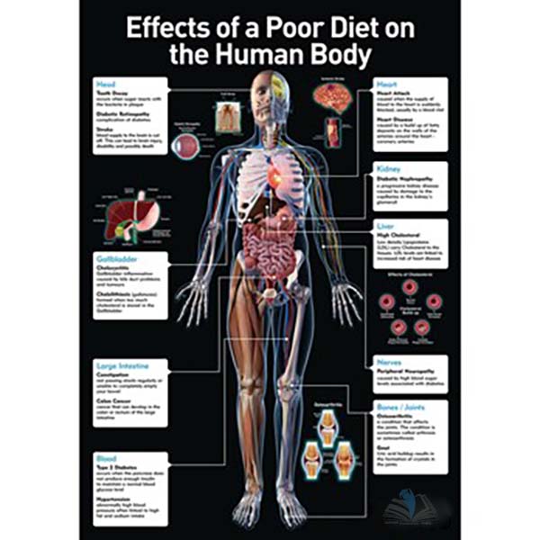 Effects of a Poor Diet On the Body Poster
