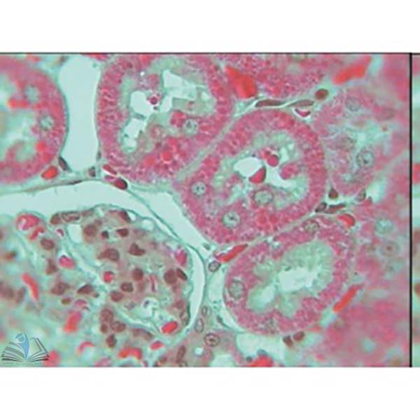 Prepared Microscope Slide - Golgi Bodies in Spinal Ganglion