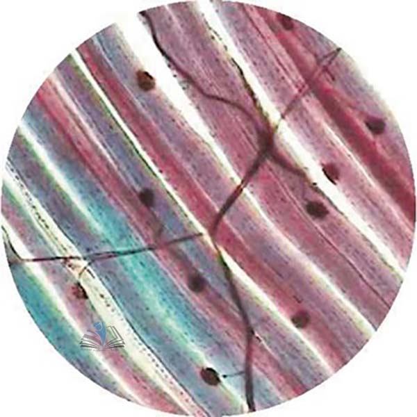 Prepared Microscope Slide - Human Pacinian Corpuscle Skin or Pancreas V.S.
