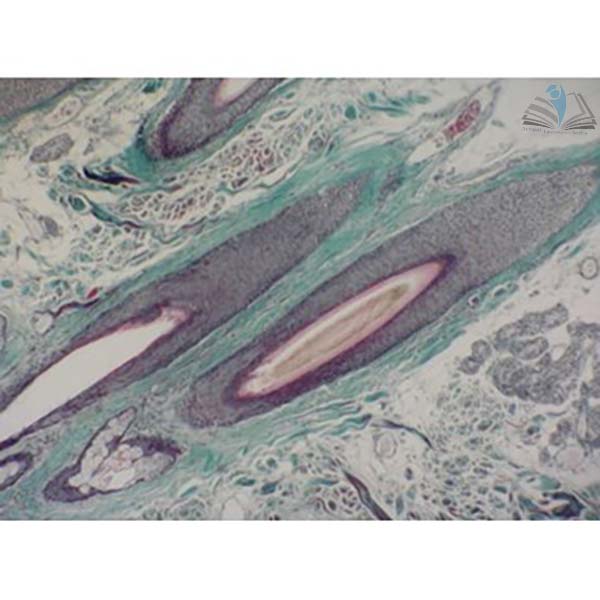 Prepared Microscope Slide Set - Human Scalp and Hair