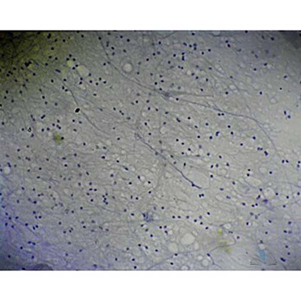 Prepared Microscope Slide - Nerve Cells Spinal Cord Smear
