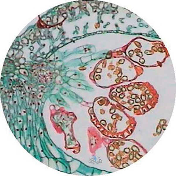 Prepared Microscope Slide - Fern (Dryopteris filix-Mas) Pinnule with Sori. T.S.