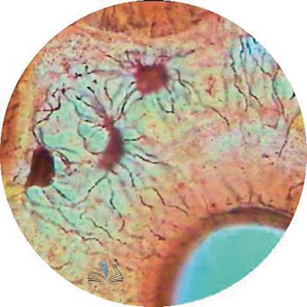 Prepared Microscope Slide - Red Bone Marrow Smear